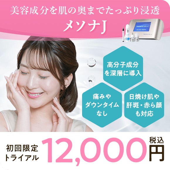 メソナJ