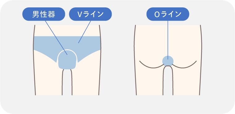 メンズ医療脱毛（デリケートゾーン・メンズvio）の照射部位