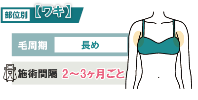 【ワキ】毛周期が長めで2～3か月間隔が効果的