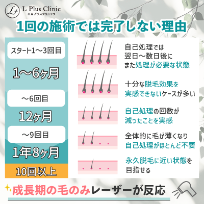 永久脱毛で1回の施術では完了しない理由