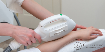 ②脱毛機の種類で比較する
