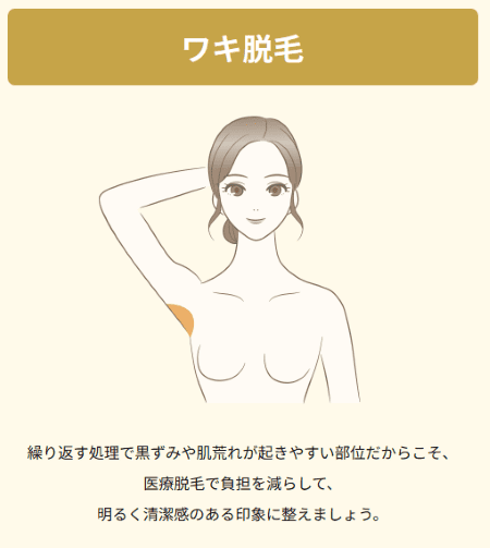 レジーナクリニック_脇脱毛