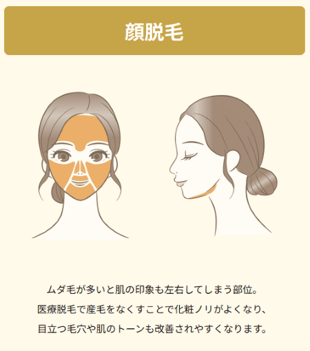 レジーナクリニック_顔脱毛